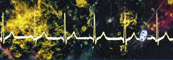 Robleto - SETI AIR artwork